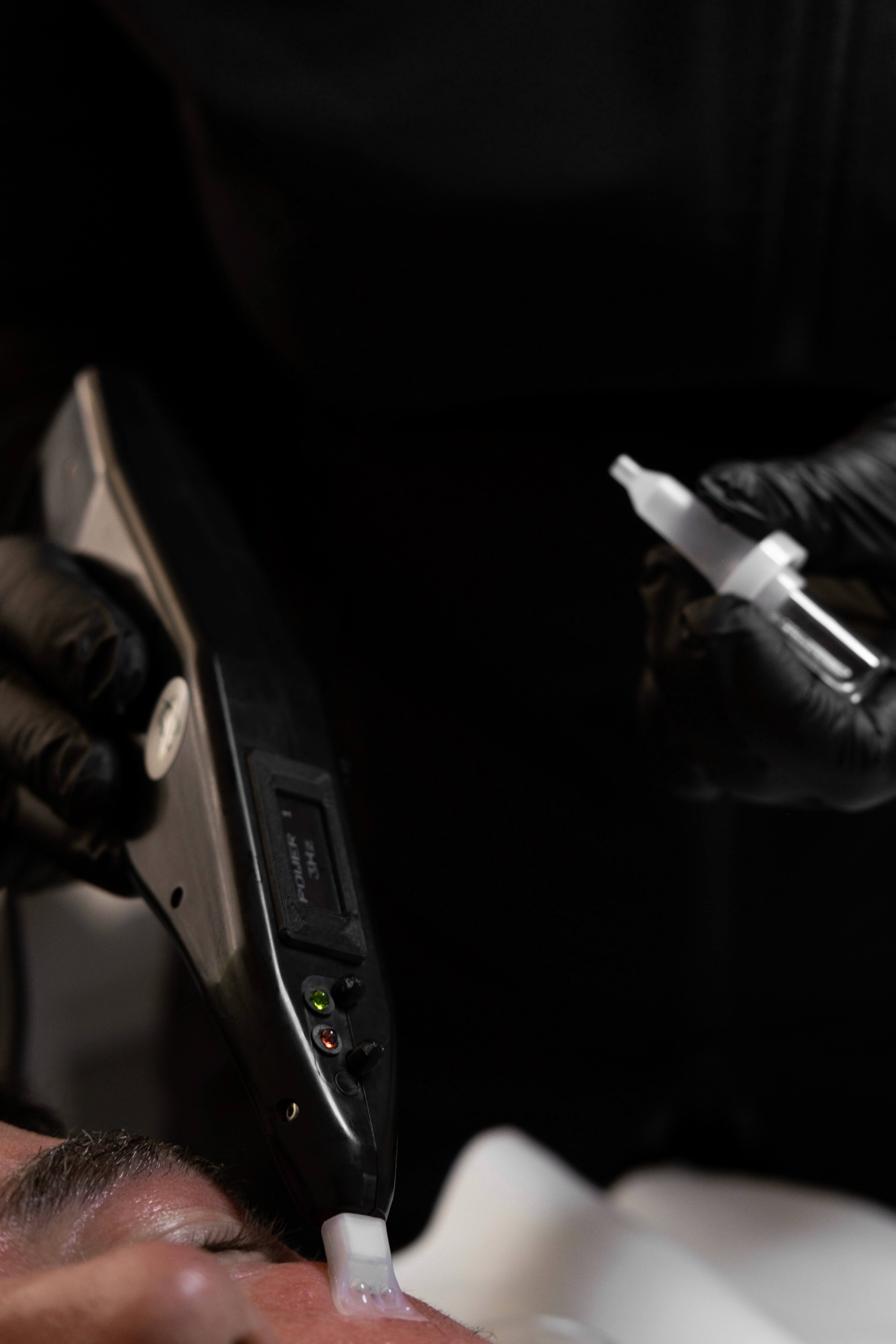 Behandlung mit dem BioRef-DC Gerät zur Hautverjüngung